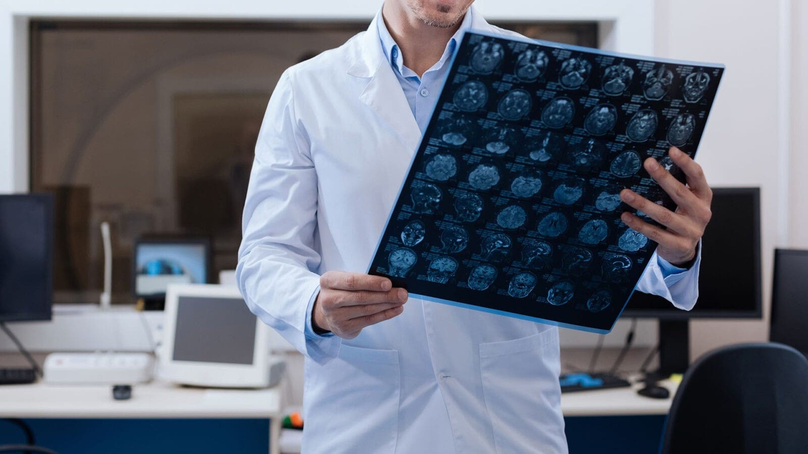 Brain X-Ray